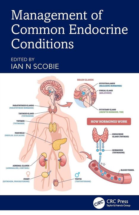 "Management of Common Endocrine Conditions" von Ian N. Scobie. Illustration der endokrinen Drüsen im menschlichen Körper.