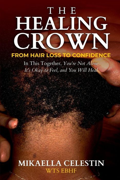 "The Healing Crown: From Hair Loss to Confidence. In This Together, You're Not Alone. Es zeigt eine Nahaufnahme eines Kopfes."