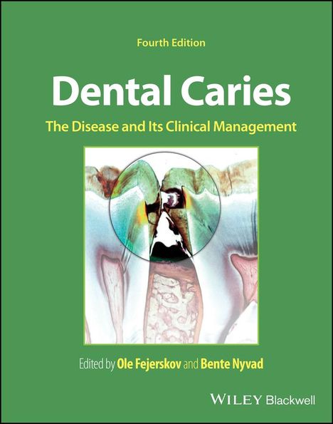 Dental Caries, Buch