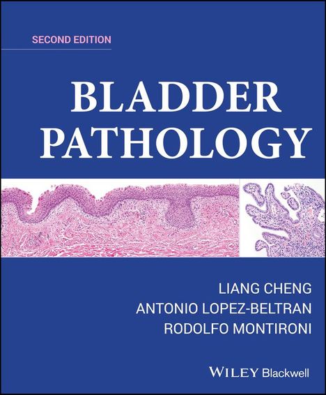 Antonio Lopez-Beltran: Bladder Pathology, Buch