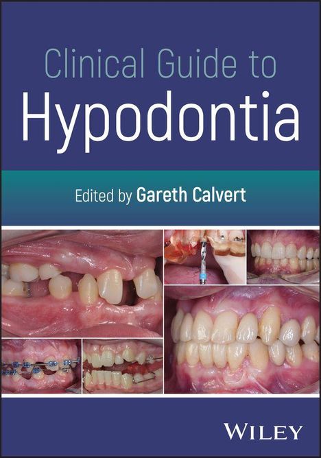 „Clinical Guide to Hypodontia“ von Gareth Calvert. Fotos zeigen zahnmedizinische Nahaufnahmen. Logo unten: Wiley.