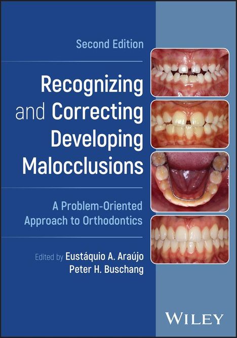 Recognizing and Correcting Developing Malocclusions, Buch