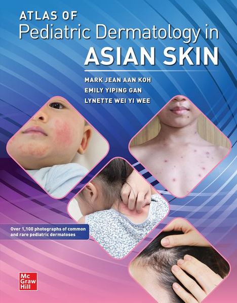 Mark Jean Aan Koh: Atlas of Pediatric Dermatology in Asian Skin, Buch