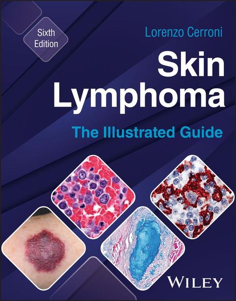 Lorenzo Cerroni: Skin Lymphoma, Buch