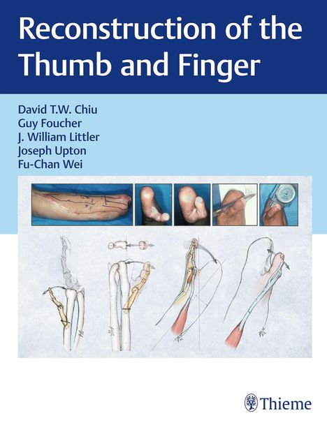 Reconstruction of the Thumb and Finger, 1 Buch und 1 Diverse