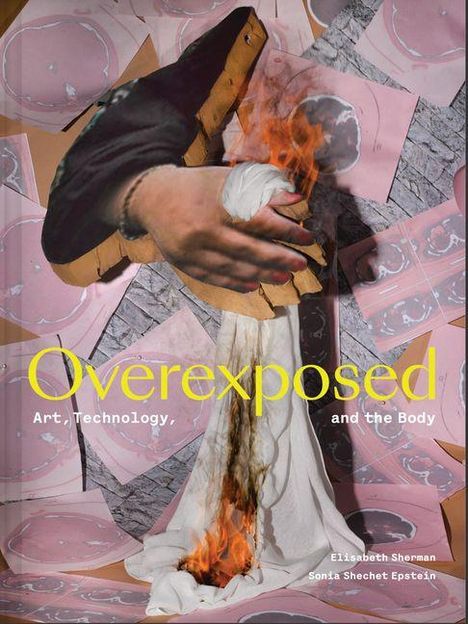 "Overexposed: Art, Technology, and the Body" von Elisabeth Sherman, Sonia Shechet Epstein. Illustration: Hand hält brennenden Stoff.