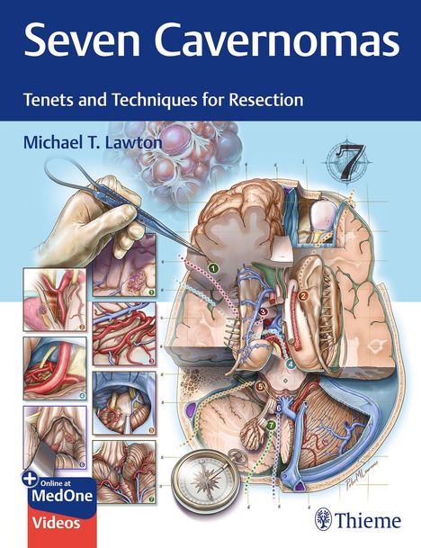 Michael T. Lawton: Seven Cavernomas, Buch