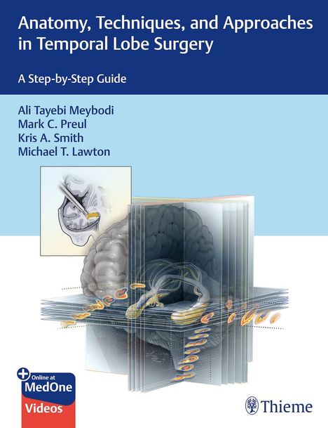 Titel: Anatomy, Techniques, and Approaches in Temporal Lobe Surgery. Darstellung eines Gehirns mit schematischen Schnitten.