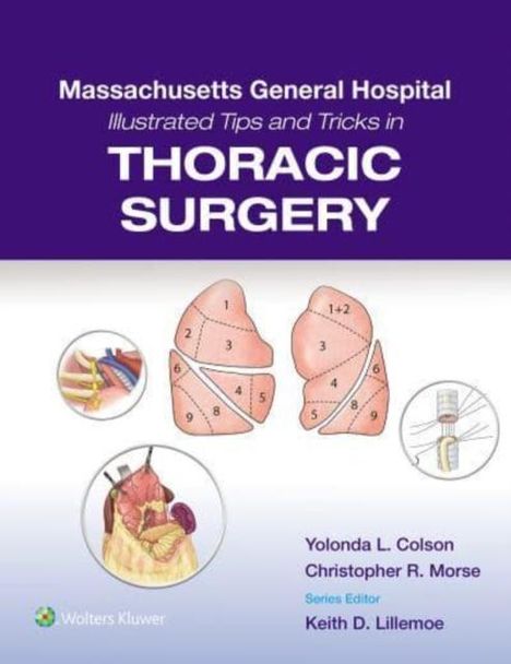 Massachusetts General Hospital Illustrated Tips and Tricks in Thoracic Surgery: Print + eBook with Multimedia, Buch