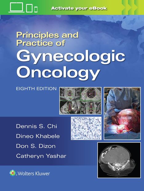 Andrew Berchuck: Principles and Practice of Gynecologic Oncology, Buch
