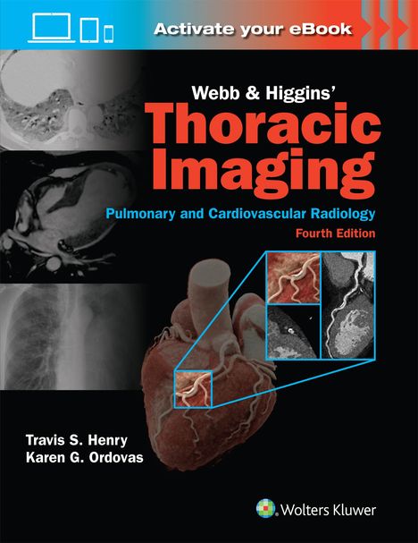 Travis Scott Henry: Webb &amp; Higgins Thoracic Imaging: Print + eBook with Multimedia, Buch