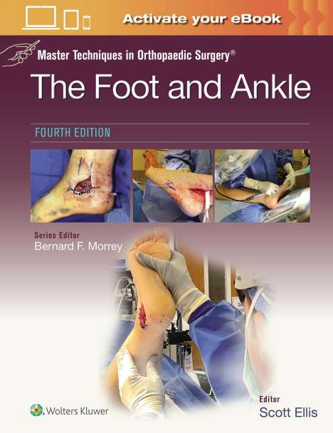 Scott Ellis: Master Techniques in Orthopaedic Surgery: The Foot and Ankle: Print + eBook with Multimedia, Buch
