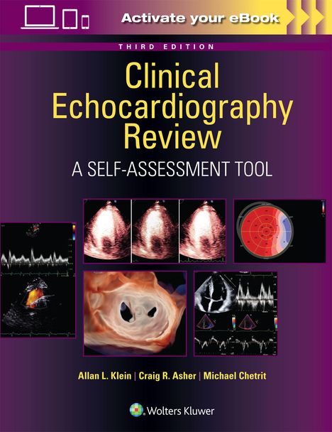 Clinical Echocardiography Review, Buch