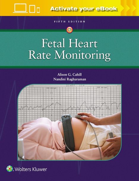 Alison Cahill: Fetal Heart Rate Monitoring, Buch