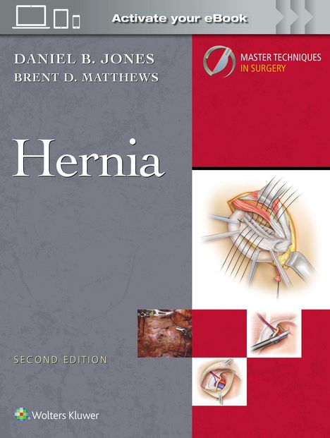 Daniel B Jones: Master Techniques in Surgery: Hernia: Print + eBook with Multimedia, Buch