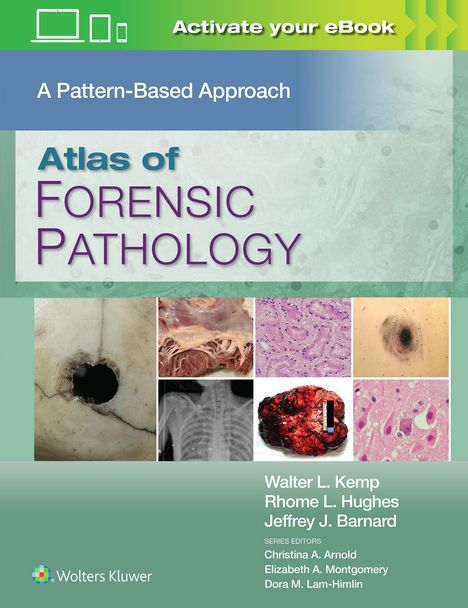 Walter L. Kemp: Kemp, W: Atlas of Forensic Pathology: A Pattern Based Approa, Buch