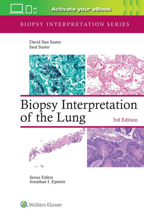 David Ilan Suster: Biopsy Interpretation of the Lung, Buch