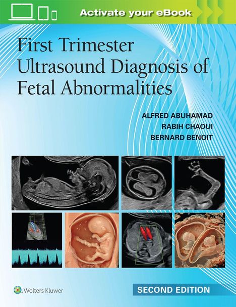 „First Trimester Ultrasound Diagnosis of Fetal Abnormalities“ steht auf blauem Hintergrund. Unten sind Ultraschallbilder.