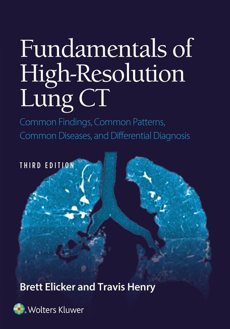 „Fundamentals of High-Resolution Lung CT“, drittes Edition. Bild einer CT-Lunge in Blau. Autoren: Brett Elicker und Travis Henry.