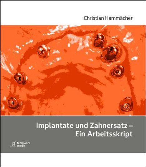 "Christian Hammächer. Implantate und Zahnersatz – Ein Arbeitsskript. Orange-rote Illustration mit fünf Zahnersatzteilen."