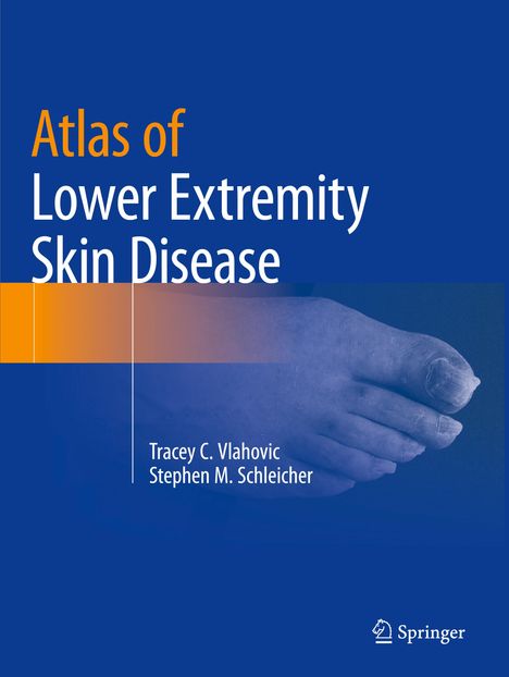 Stephen M. Schleicher: Atlas of Lower Extremity Skin Disease, Buch
