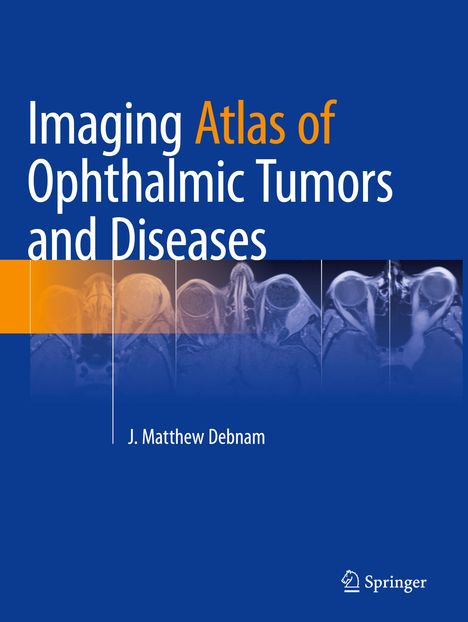 Imaging Atlas of Ophthalmic Tumors and Diseases, Buch