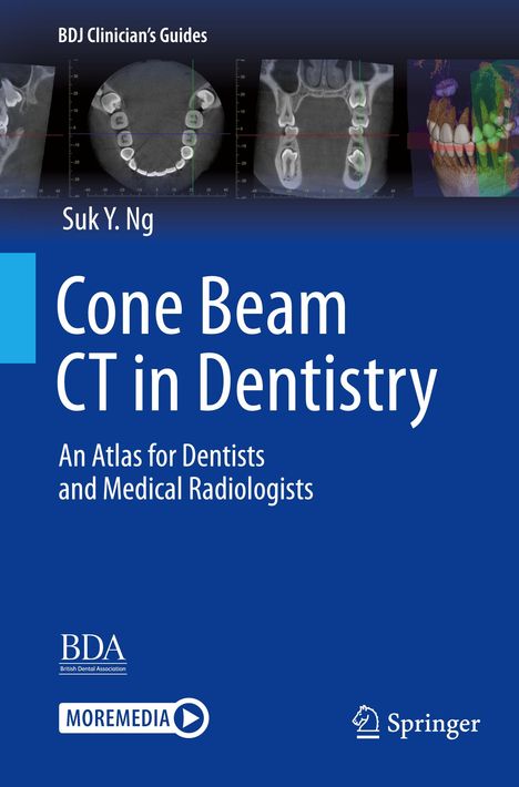 Suk Y. Ng: Cone Beam CT in Dentistry, Buch