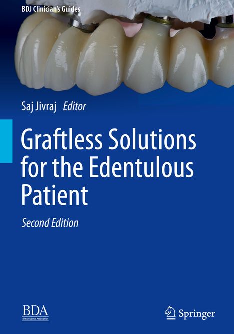 Graftless Solutions for the Edentulous Patient, Buch