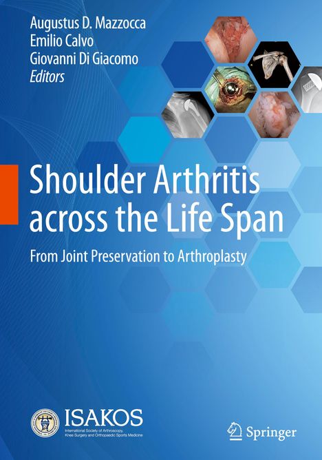 Shoulder Arthritis across the Life Span, Buch