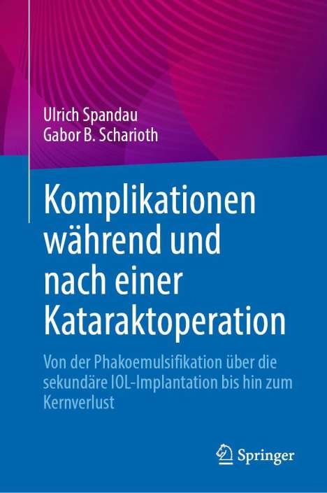 Ulrich Spandau: Komplikationen während und nach einer Kataraktoperation, Buch