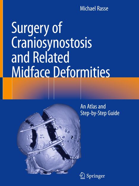 Michael Rasse: Surgery of Craniosynostosis and Related Midface Deformities, Buch