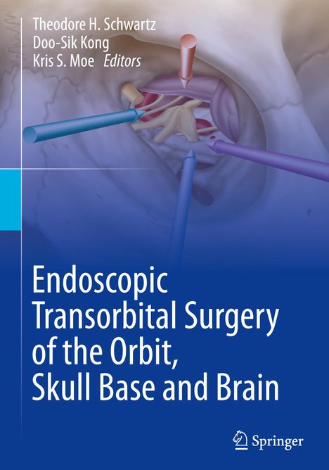 Endoscopic Transorbital Surgery of the Orbit, Skull Base and Brain, Buch