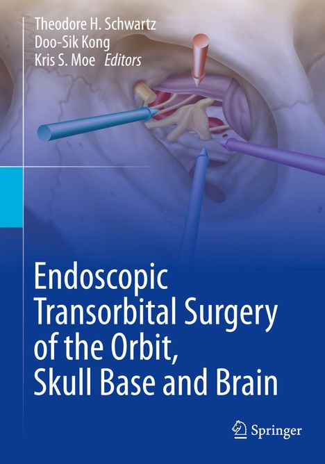 Text: "Endoscopic Transorbital Surgery of the Orbit, Skull Base and Brain". Illustration von chirurgischen Instrumenten.