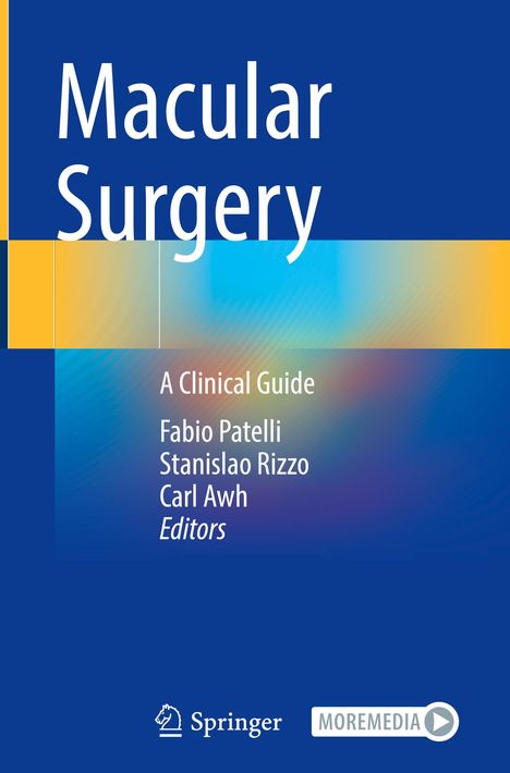 Macular Surgery, Buch