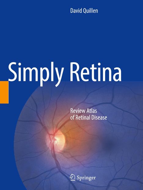 "Simply Retina: Review Atlas of Retinal Disease" steht vor einem blauen Hintergrund mit einem Bild der Netzhaut. Springer-Logo unten.
