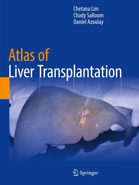 Titel: Atlas of Liver Transplantation. Autoren: Chetana Lim, Chady Salloum, Daniel Azoulay. Bild: Leber in Handschuhen.