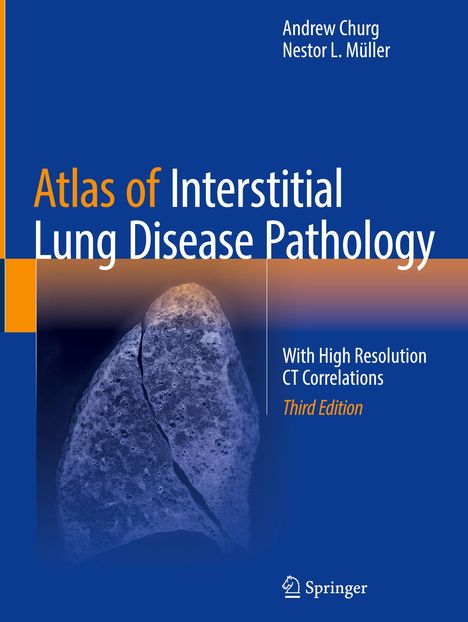 Nestor L. Müller: Atlas of Interstitial Lung Disease Pathology, Buch