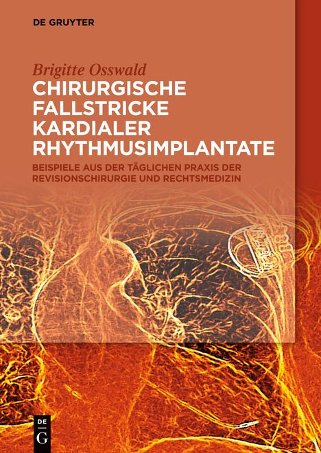 Brigitte Osswald: Chirurgische Fallstricke kardialer Rhythmusimplantate, Buch