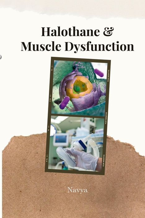 Navya: Halothane &amp; Muscle Dysfunction, Buch