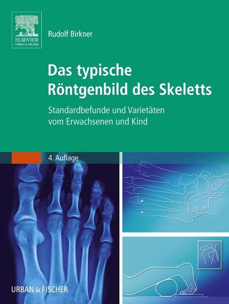 Rudolf Birkner: Das typische Röntgenbild des Skeletts, Buch