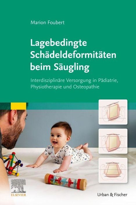 "Marion Foubert. Lagebedingte Schädeldeformitäten beim Säugling. Baby spielt mit buntem Spielzeug, Zeichnungen von Schädeln."
