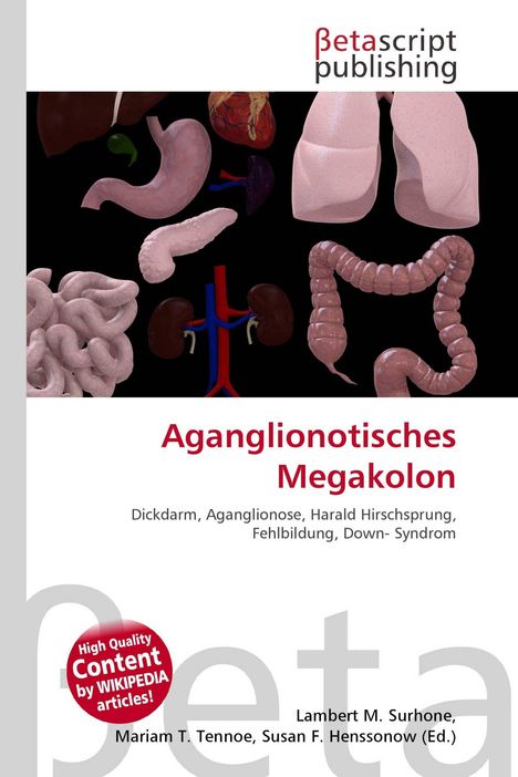 Titel: Aganglionotisches Megakolon. Darstellung von Organen, darunter Magen und Darm, mit medizinischem Bezug.