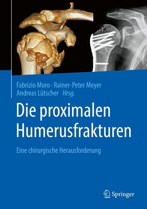 Die proximalen Humerusfrakturen, Buch