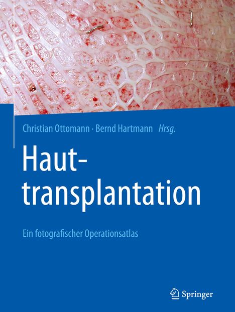 Hauttransplantation, Buch
