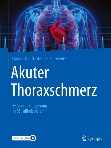 Andrea Radzewitz: Akuter Thoraxschmerz, Buch