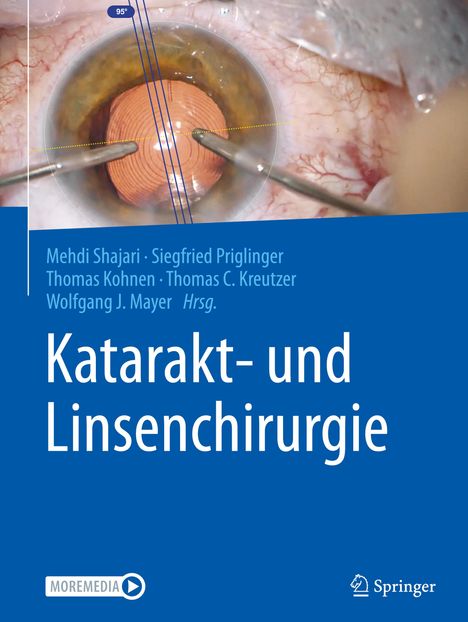 Katarakt- und Linsenchirurgie, Buch