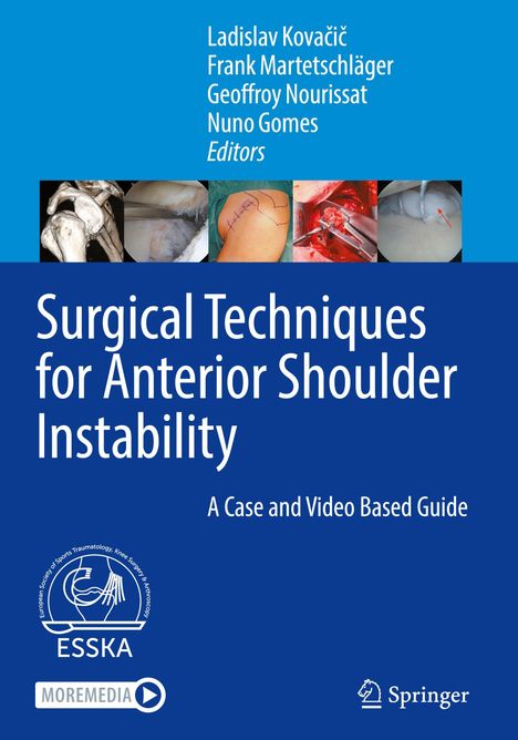 Titel: "Surgical Techniques for Anterior Shoulder Instability". Oben Aufnahmen von chirurgischen Verfahren. Unten Logos von ESSKA und Springer.