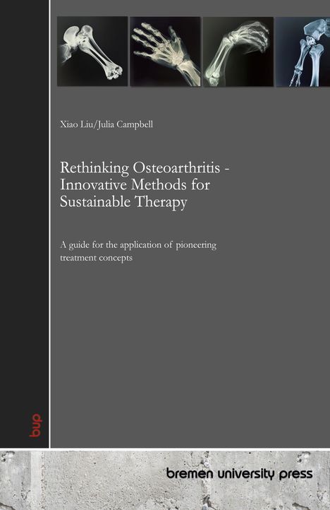 Titel: Rethinking Osteoarthritis - Innovative Methods for Sustainable Therapy. Oben sind vier Röntgenbilder von Gelenken.