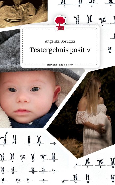 Angelika Borutzki: Testergebnis positiv. Life is a Story - story.one, Buch