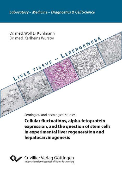 Wolf-Dieter Kuhlmann: Cellular fluctuations, alpha-fetoprotein expression, and the question of stem cells in experimental liver regeneration and hepatocarcinogenesis, Buch
